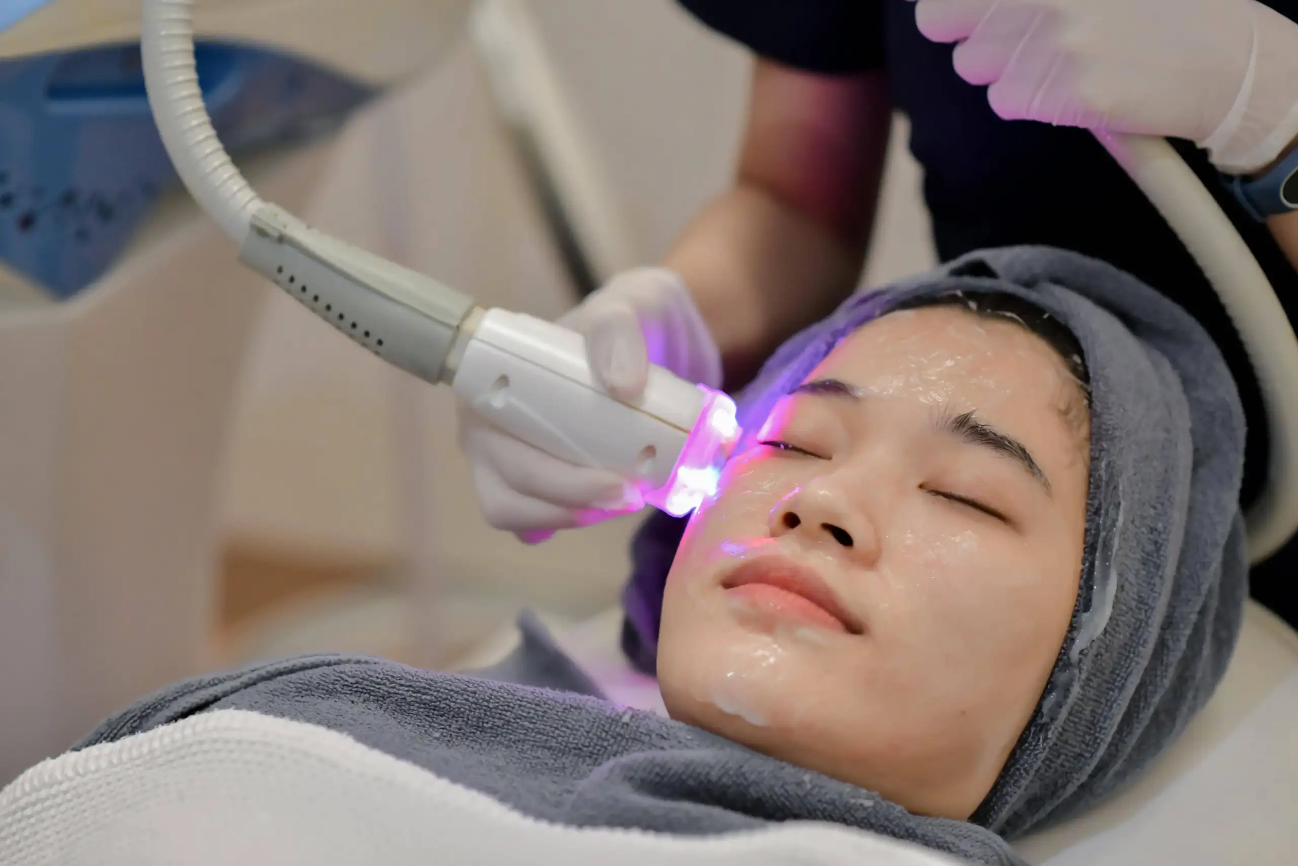 Laser Treatments