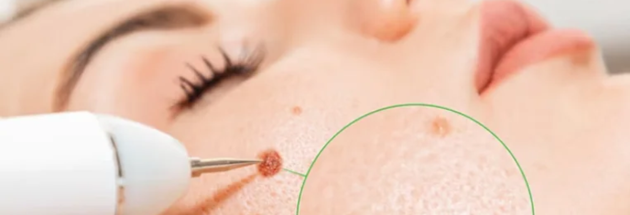 Skin Esthetics Clinic Uk