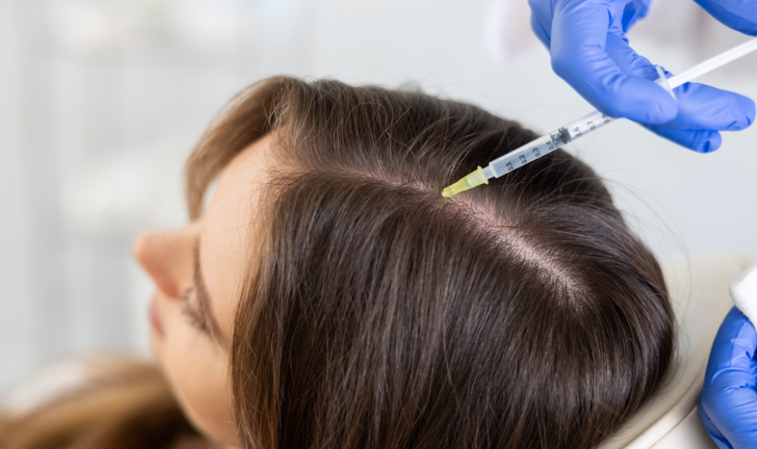 prp hair treatment