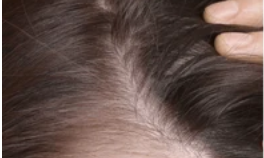 before scalp health treatment